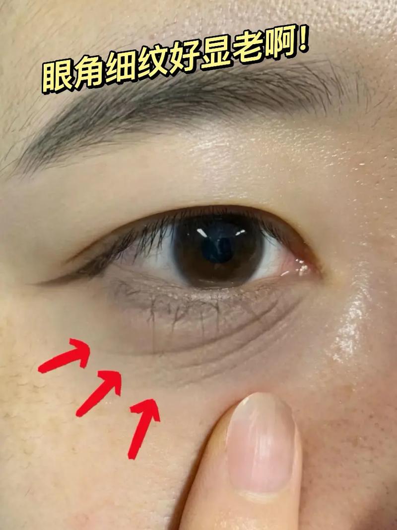 35岁baby眼角细纹藏不住,眼角细纹的形成原因