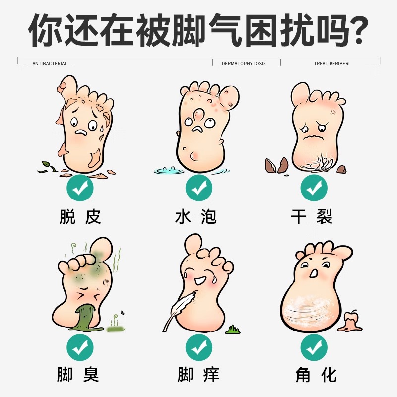 脚臭噩梦终结者：洛芙联苯苄唑喷雾剂，告别脚气困扰！