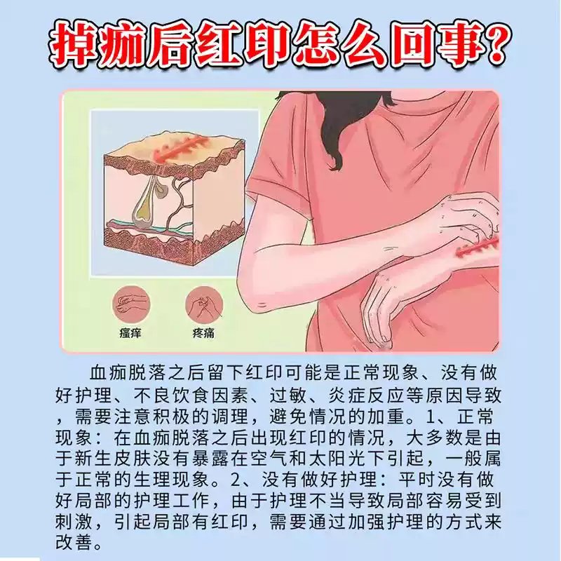 祛疤最有效的方法是什么？如何科学修复肌肤？