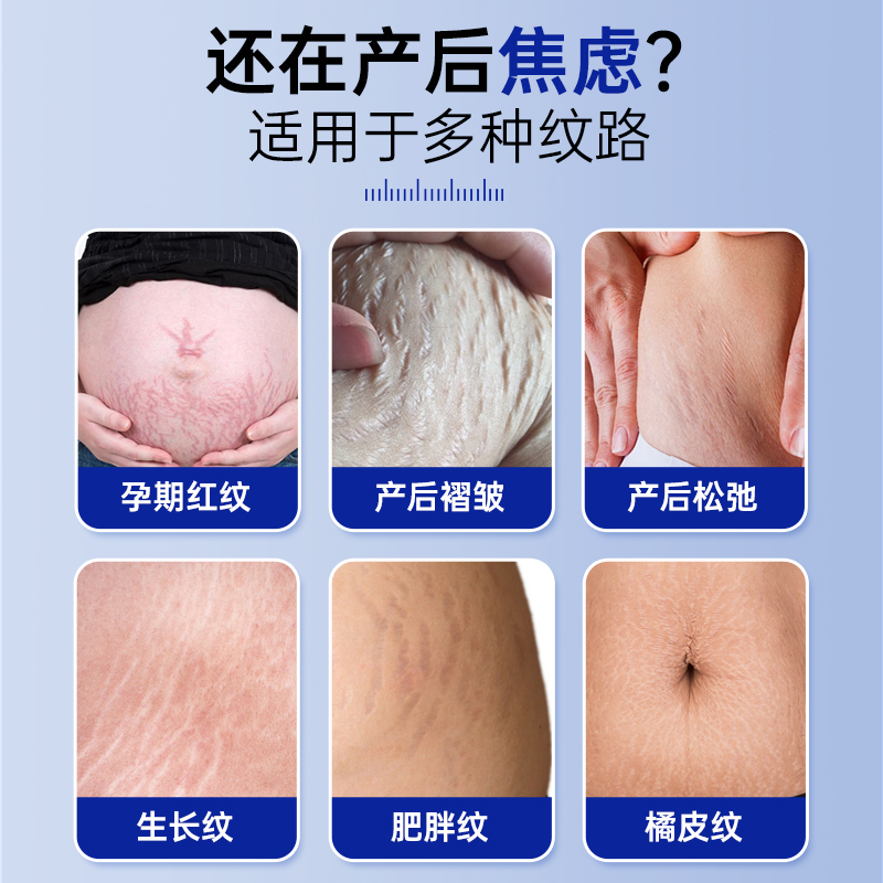 中英医美研究院去妊娠纹专用修复膏，告别肥胖纹，重塑紧致肚皮！✨