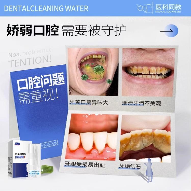 【胖东莱爆卖】牙结石去除神器，告别黄牙口臭，让你笑得自信满满