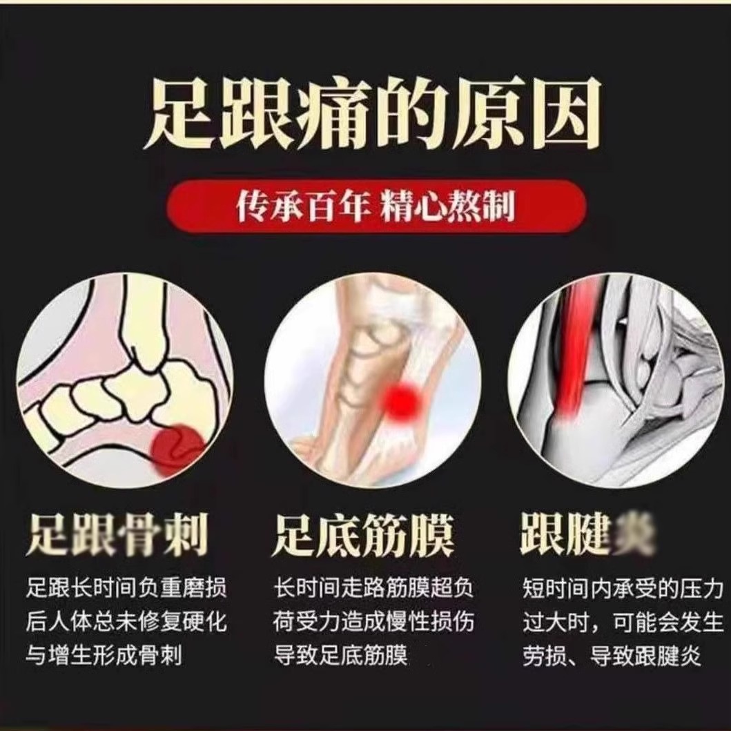 足跟疼痛101%根治？揭秘足跟特效膏药背后的真相与误区