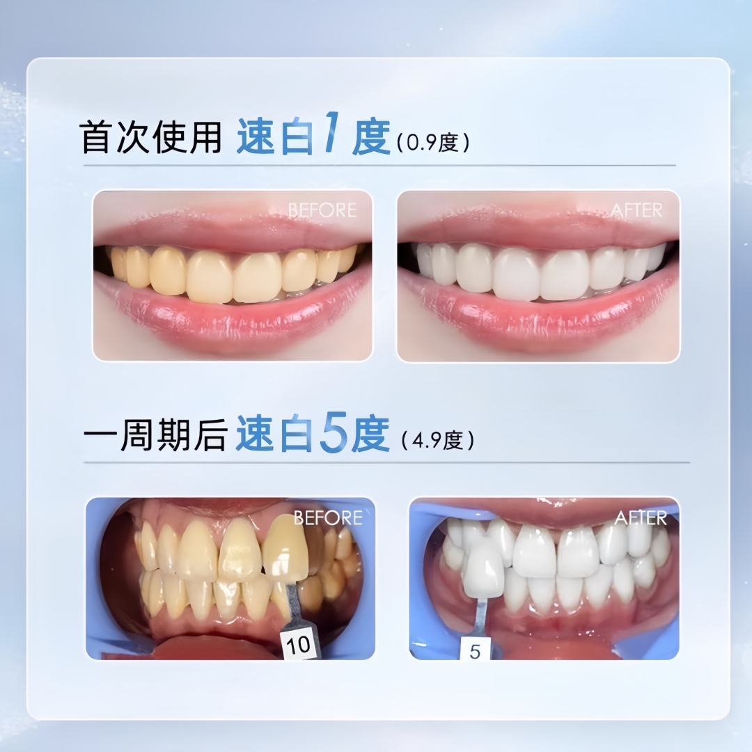 【牙白到发光】美白牙膜+凝胶，告别黄牙烟渍，牙齿亮白新体验！