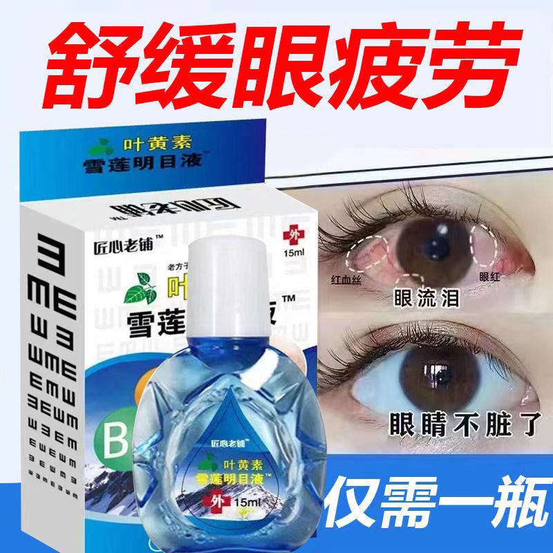 叶黄素眼药水对眼睛真的有效吗？小白必看，拯救你的“视”界！